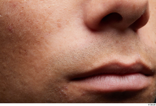 HD Face Skin Nathaniel cheek face lips mouth nose skin…